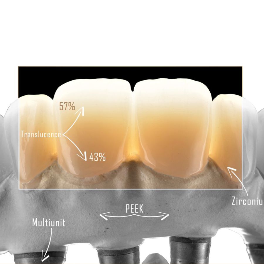 AIDITE® 3D Pro-Zir : A1